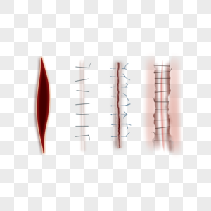 手术医疗缝合伤口图片