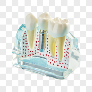 牙龈牙齿模型高清图片