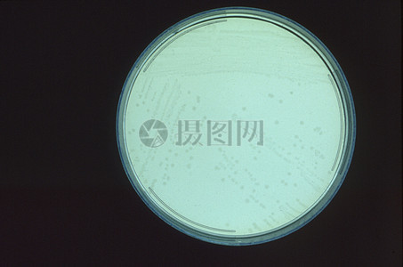 这些产气荚膜梭菌菌落在sps亚多粘菌素磺胺嘧啶琼脂平板上培养