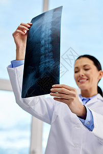 女医生与X光图片