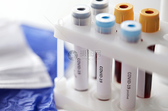医学,医疗大流行烧杯与冠状病血液测试持有人实验室接受冠状病血液测试的烧杯图片