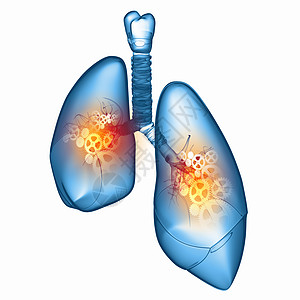 人类的肺机制的人肺健康医学图片