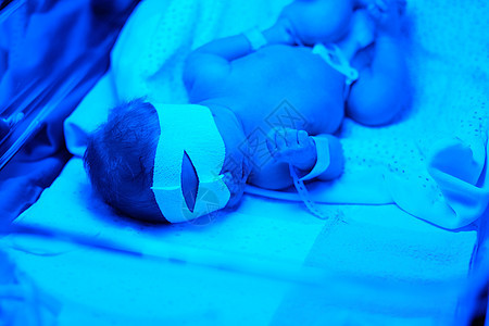 两天大的新生婴儿蓝色紫外线下拍照背景图片