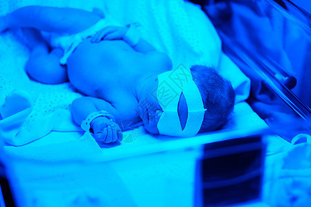 两天大的新生婴儿蓝色紫外线下拍照背景图片
