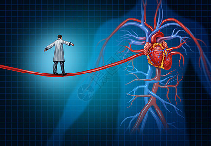 心脏手术的心脏外科医生行走条形状为高钢丝绳的动脉上,种心脏病内部心血管器官心脏病学的医学理念图片