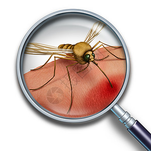 蚊子病医学健康与放大镜寨卡病风险符号密切相关,种昆虫叮咬人类皮肤传播疾病,造成公共健康危害传播感染背景图片