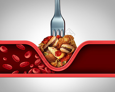 循环食物差,导致动脉人静脉堵塞,如叉子,油腻的快餐,导致动脉狭窄,阻断血液流向人的心脏器官,3D插图元素背景图片