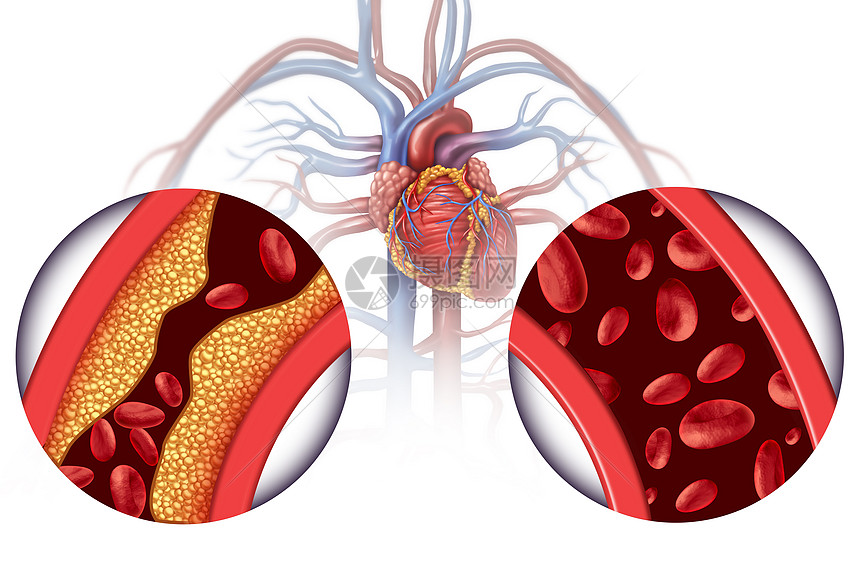 治疗心脏病血液循环疾病图片
