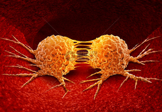 将癌细胞移分裂种疾病解剖,人体内器官上生长的恶肿瘤,三维图示分裂癌细胞图片