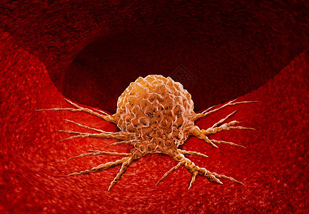 癌症解剖种生长的肿瘤细胞恶疾病人体内器官上的生长,三维插图癌症解剖图片