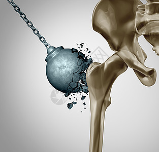强壮的骨骼健康的人体骨骨伤科力量矿物密度医学个破坏球被骨质疏松预防医学破坏三维插图图片