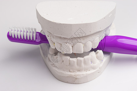 口腔卫生健康理念牙科石膏模型石膏中的特写紫牙刷图片