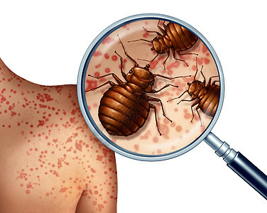 臭虫叮咬人体皮肤臭虫侵扰的放大,寄生害虫卫生标志健康危险的吸血寄生虫与三维插图元素图片