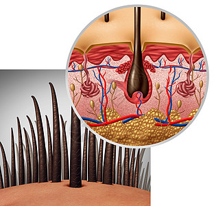 皮肤解剖图毛囊解剖图Dermitology医学人的头发与头皮出现三维插图背景