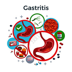 胃炎疾病症状导致药物扁平圆形成健康受影响的胃细菌食物矢量插图背景图片