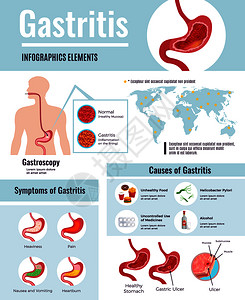 胃炎症状胃溃疡引的信息健康的食物惯世界人口影响信息图片海报矢量插图背景图片