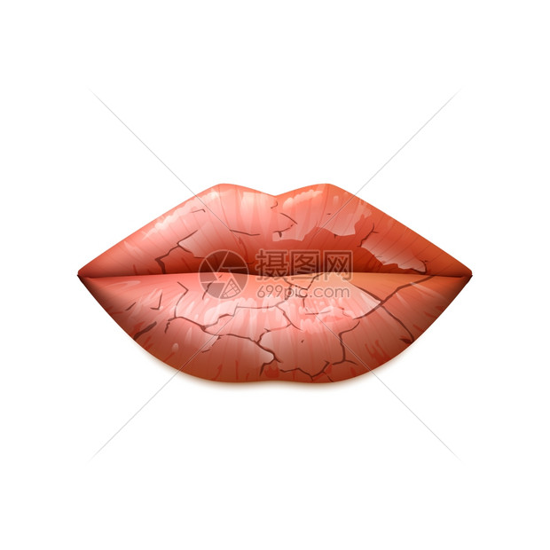 干嘴唇插图干裂的女人嘴唇个经典的形状,现实的孤立矢量插图图片