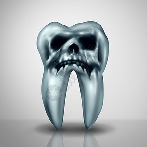 牙齿腐烂病的危险作为洞穴或的象征表明由于细菌和酸牙齿解剖有腐烂的危险这些细菌和酸形成头骨腐烂成三德制图片