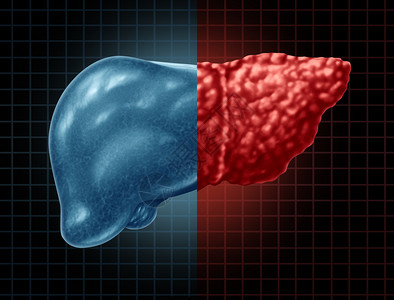 肝脏解毒作为消化系统解剖和三维插图样式消化功能重要器官的医学保健概念一部分,肝脏和病以及血胃身体是三维插图样式中消化功能的重要器官。背景