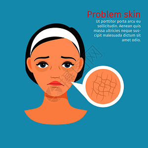 妇女面临干皮肤问题矢量说明妇女面临干皮肤问题图片