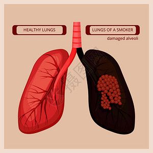 肺病损坏的肺高清图片
