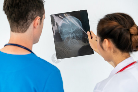 女医生在医院与另一名医护人员一起检查病人头部受伤的x光片图片