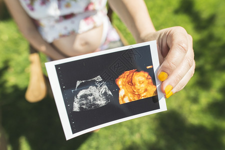 孕妇在花园展示子宫的照片背景图片