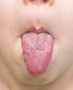 近距离拍下婴儿舌头图片