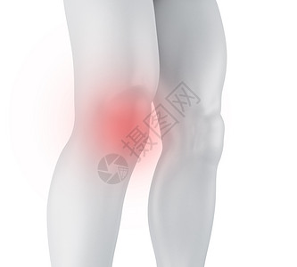 3个插图膝盖痛医学概念孤立的白种背景图片