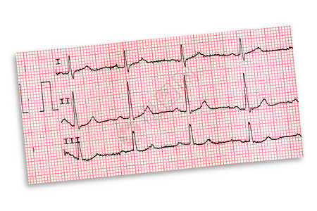 白色背景上孤立的心电图图片
