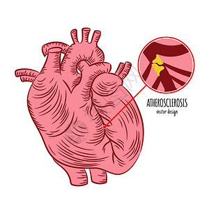 医学教育图心脏图片