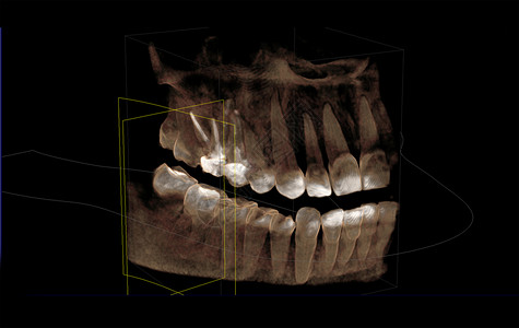 3d可视化计算机缩写图的直映图片