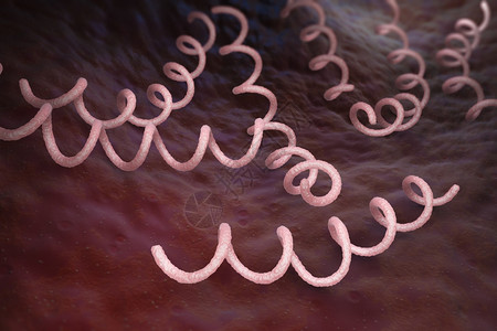 梅毒是一种传染感由细菌Treponemapllidum亚种引起的背景图片