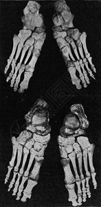 人右脚和左的骨骼刻着古老的图解来自宇宙和人类190年图片