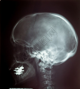 用电脑人体头骨X光胶片背景