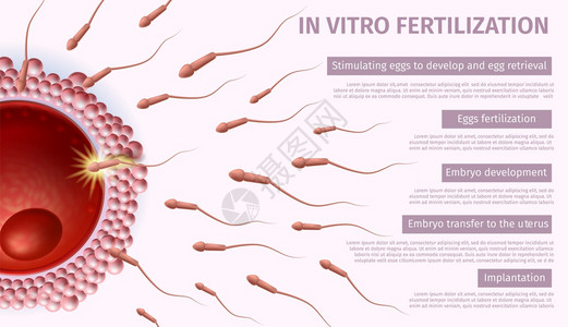 体外受精步骤清单粉红背景下流向女卵的细胞IVF生殖医学病媒现实说明生殖诊所医疗禁令复制空间图片