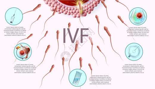 体外受精过程近距离接的微生物研究视图实验室设备和IVF图标的阶段病媒现实说明具有复制空间的人类生殖医学禁区带有复制空间的人类生殖图片