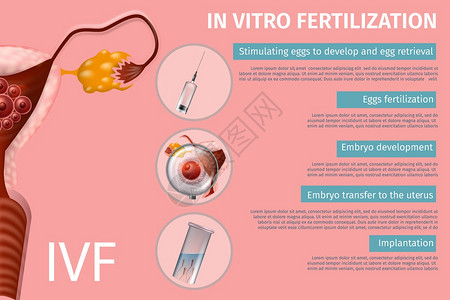 体外受精阶段刺激卵Embryo开发向Uretrus转移植入女生殖系统IVF病媒现实说明医疗封条复制空间图片