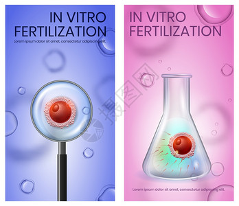 试管内女卵子受精情况Spermatozons攻击女细胞放大镜矢量现实说明海报复制空间试管内女卵子受精情况图片