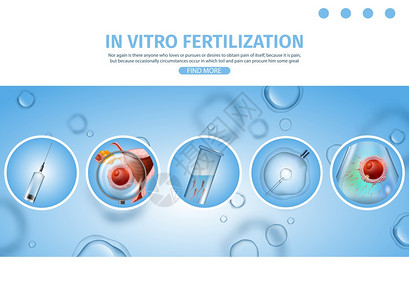 含有IVF程序说明的体外授精过程荷尔蒙疗法EggRetreivalSperm注射共同孵化Embryo文化转移矢量现实图一说明IV图片