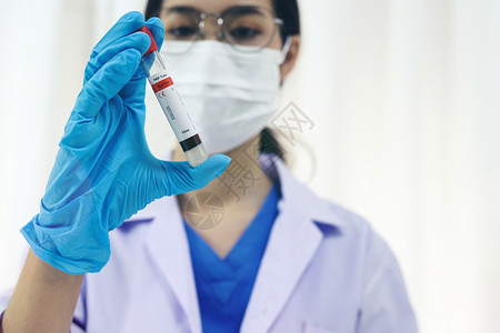 科学家持有罗纳新冠viruscovid19受感染的血液样本管DNA检测实验室中的血液使用样采集管和注射器新冠新冠19疫苗研究图片