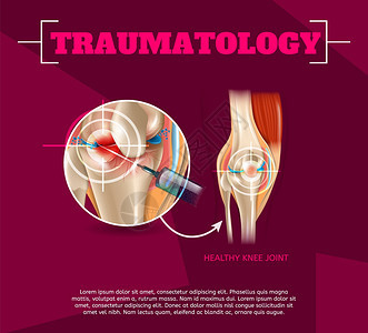 3dVectorBanner图像解剖人体膝盖联合治疗Osteoarthritis注射药物方法健康膝盖联合治疗结果图片