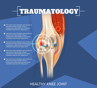 3dVectorBanner图像解剖人类健康膝合治疗Inflogs联合治疗方法创伤专门医学图片