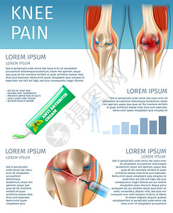 3d病媒图像解剖联合人体在治疗前后和的关节炎天然薄膜提取受影响地区的注射药物图片