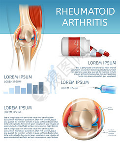 3dBannerVictorI说明人体膝盖联合疾病信息治疗药物注射以缓解疼痛背景图片