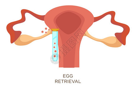 体外受精卵回收阶段人工受精病媒子宫和用卵雌生殖系统的试验管进行人工受精的子宫以及用卵女生殖系统进行测试的卵子女生殖系统的解剖育能图片