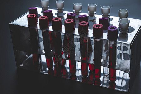 测试管中的新冠na新冠19血液测试研制疫苗和抗病物的科学实验室以及人体检测图片