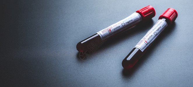 测试管中的新冠na新冠19血液测试研制疫苗和抗病物的科学实验室以及人体检测图片