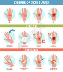 烧伤程度热急救红皮肤烧伤和泡紧急救助治疗指导热伤医南信息海报帮助诊所扁矢量测步骤热伤急救皮肤烧和泡紧急救助信息海报帮扁矢量测步骤图片