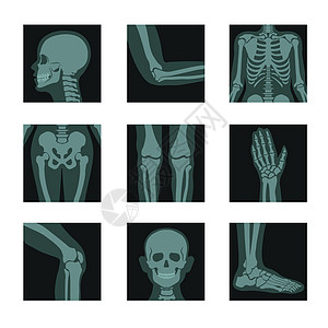 X光拍摄人体头部和手腿身体位的镜头腿和身体分的矢量肘和肋臀部膝手脚Bones或解剖骨骼系统医疗照片Skeleton和骨头X光照片图片